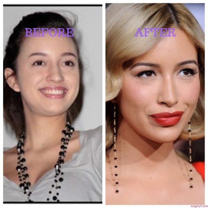 Christian Serratos Plastic Surgery Before and After