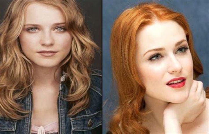 Evan Rachel Wood Plastic Surgery Before and After