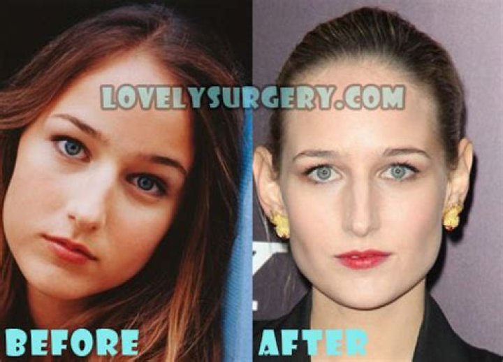 Leelee Sobieski Plastic Surgery Before and After