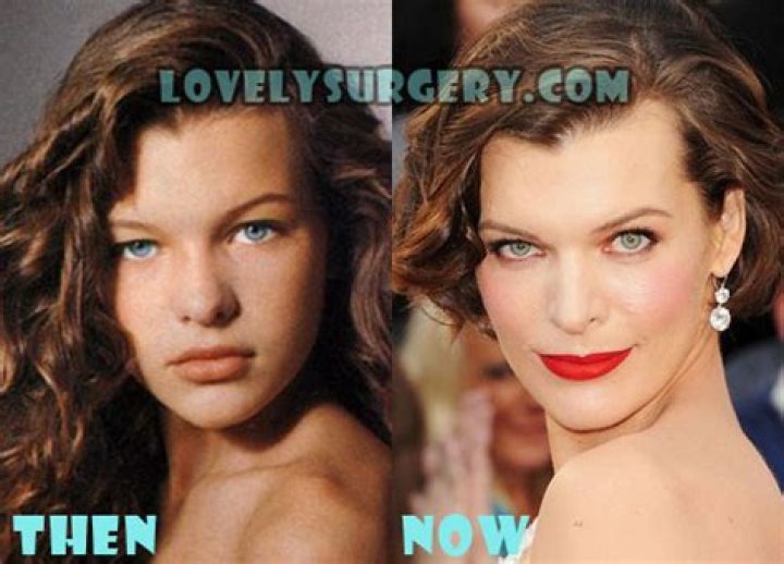 Milla Jovovich Plastic Surgery Before and After