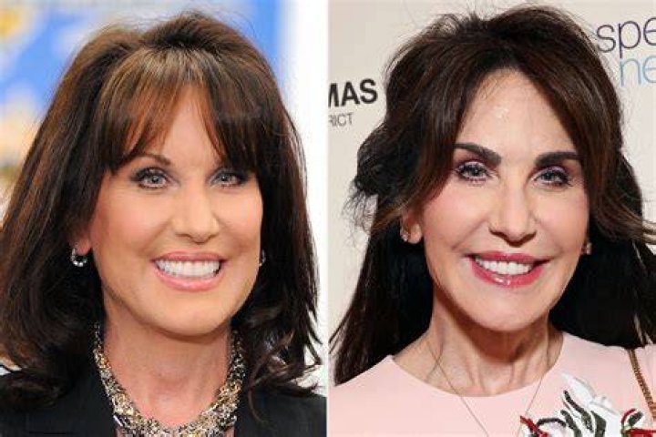 Robin McGraw Plastic Surgery